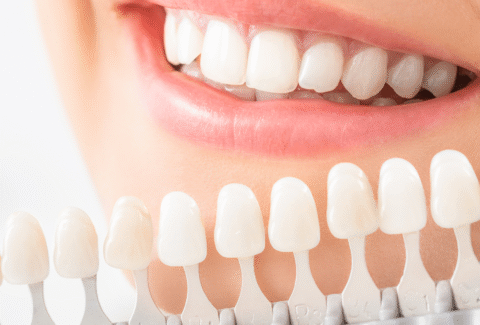 Zahnprothetik Notfall Regensdorf